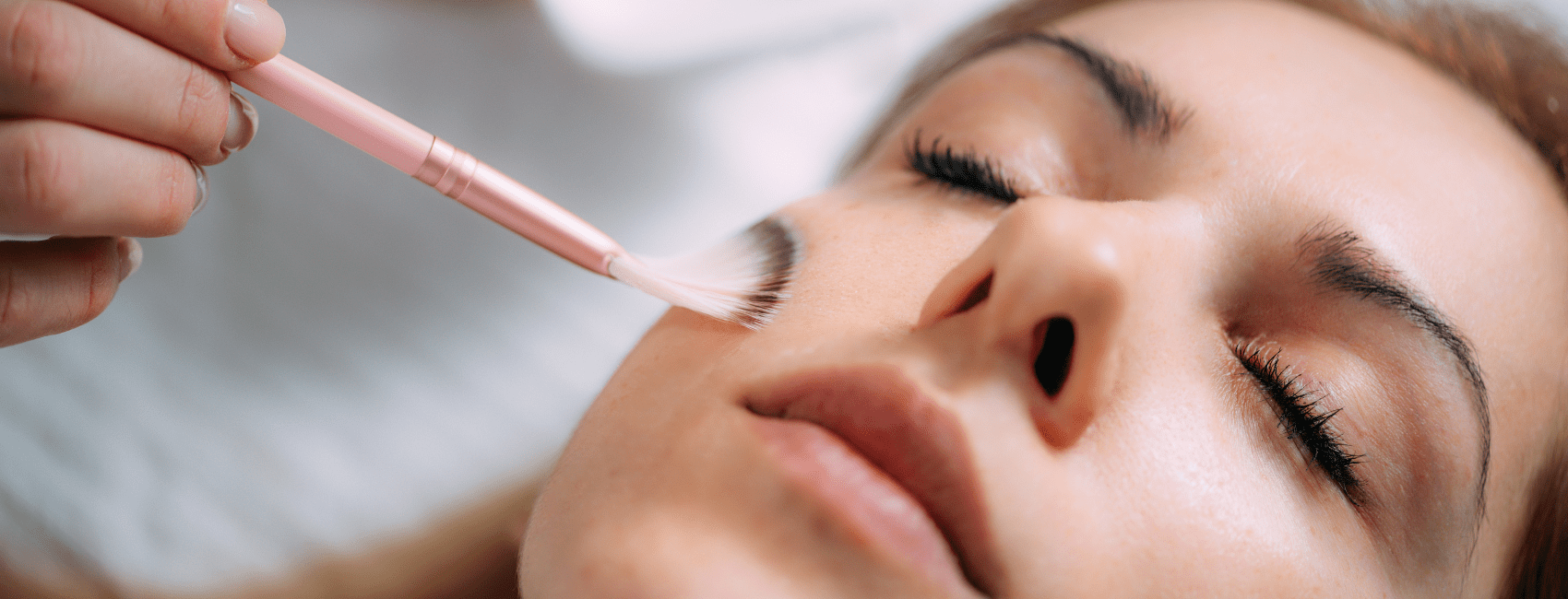 Microneedling or Chemical Peel