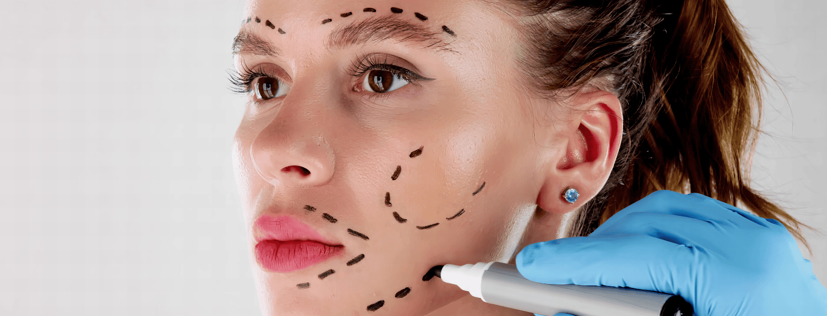 chirurgie esthétique